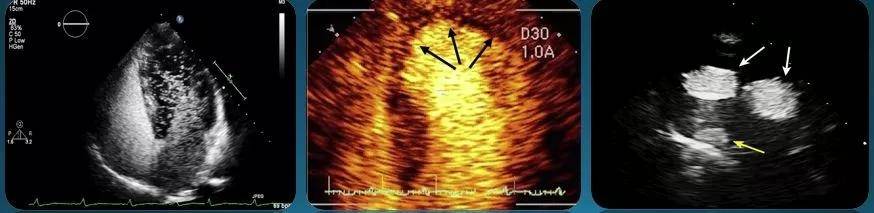 “星空体育APP网站”孔令秋 新成中医组专家:超声造影检查的基本观点(图4)